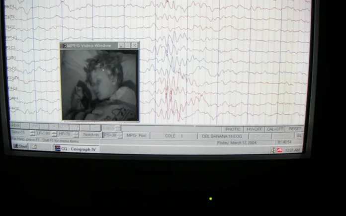 Estudio científico del sueño con EEG Registro de actividad cerebral mediante EEG durante el sueño